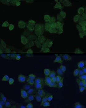 ZFYVE9 Antibody