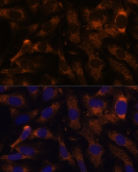 SUCLG2 Antibody
