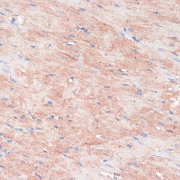 RPIA Antibody