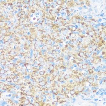 NMT1 Antibody