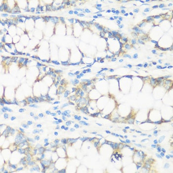 NMT1 Antibody