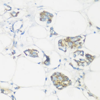 NMT1 Antibody