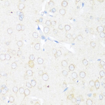 EIF3J Antibody