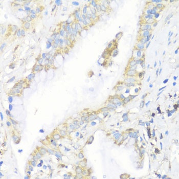 EIF3J Antibody