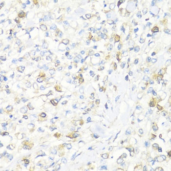 EIF3J Antibody