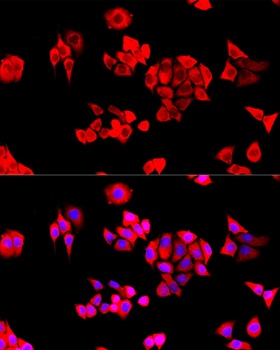 EIF3J Antibody