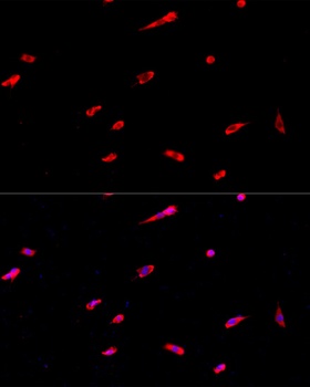 EIF3J Antibody