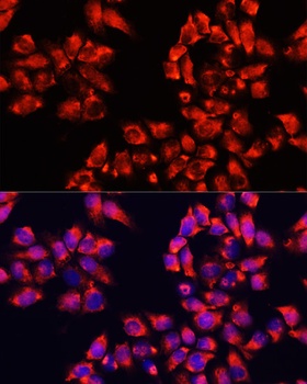 ALDH7A1 Antibody