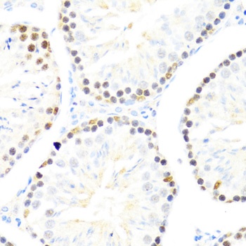 DDX50 Antibody