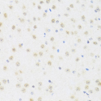 DDX50 Antibody