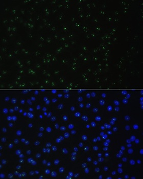 DDX50 Antibody
