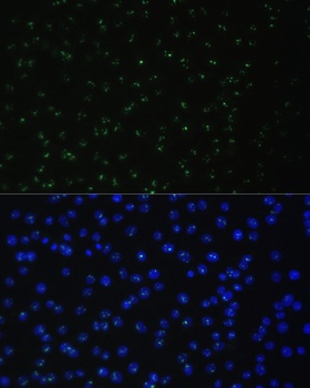 DDX50 Antibody