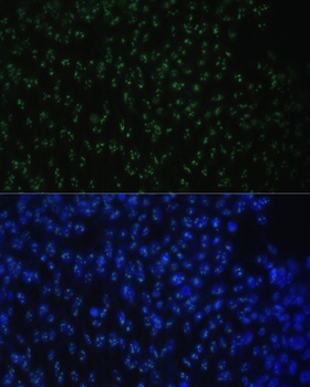 DDX50 Antibody