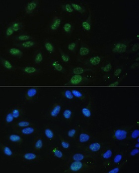 DDX50 Antibody