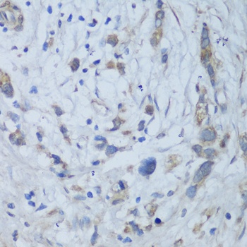 CEMIP Antibody