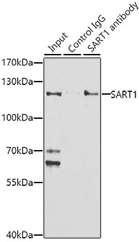 SART1 Antibody