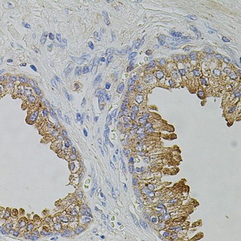 TRPA1 Antibody