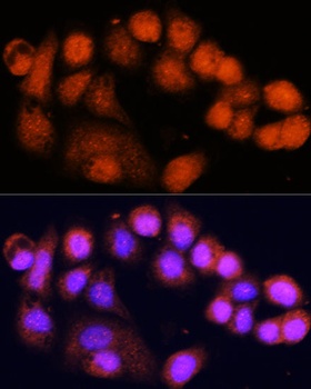 MSH4 Antibody