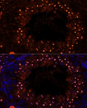 MSH4 Antibody