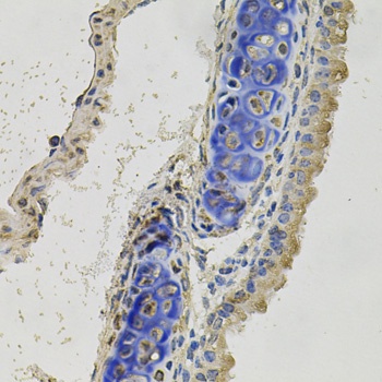 INHBB Antibody