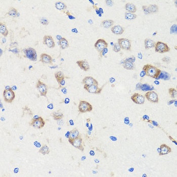 DLG1 Antibody