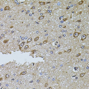 MTIF3 Antibody