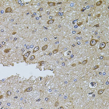 MTIF3 Antibody