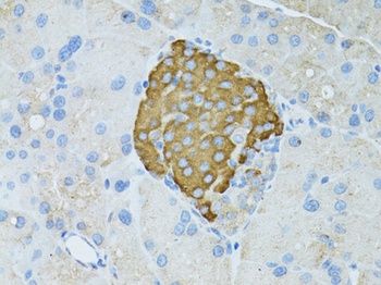 TEFM Antibody