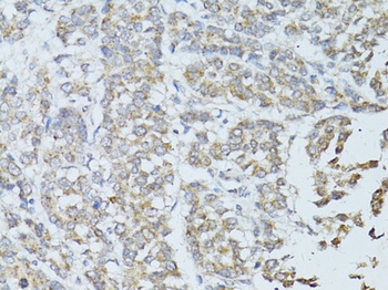 TEFM Antibody