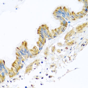 PCDHA12 Antibody