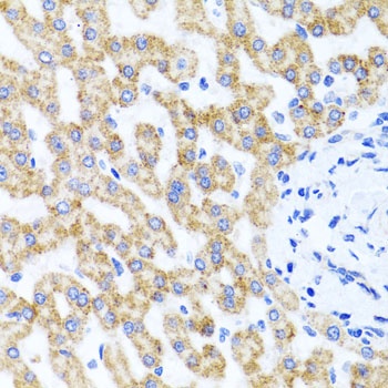 RIPK4 Antibody