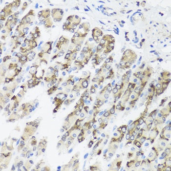 TIMM10B Antibody