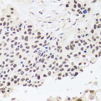 RPP30 Antibody