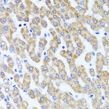 INADL Antibody