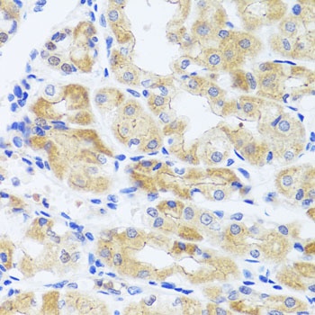 INADL Antibody