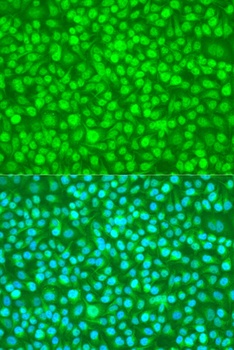 N4BP1 Antibody