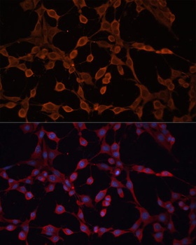 ABCB11 Antibody