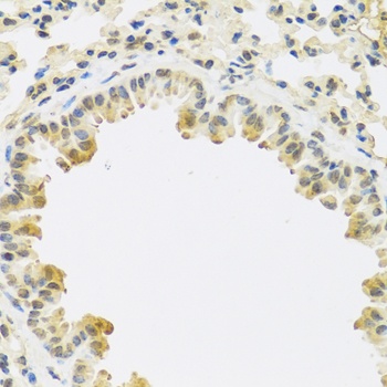 TGFB3 Antibody