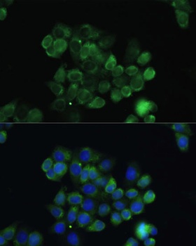 TGFB3 Antibody