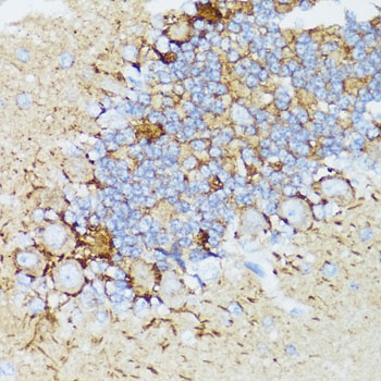 NEFH Antibody