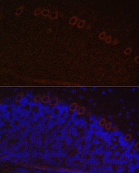 NEFH Antibody