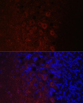 NEFH Antibody