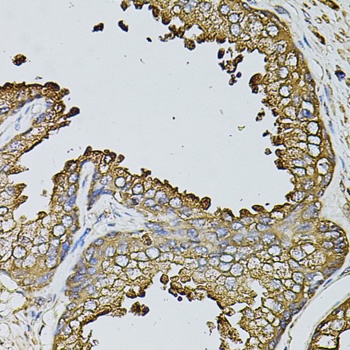 MYL1 Antibody