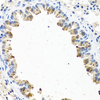 GNRH2 Antibody