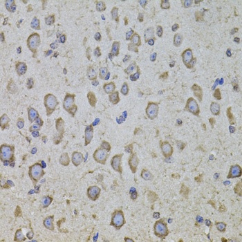 CRHR1 Antibody