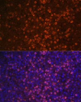 CR2 Antibody