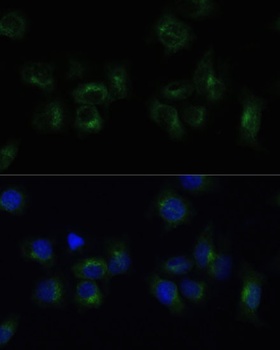 CLTB Antibody