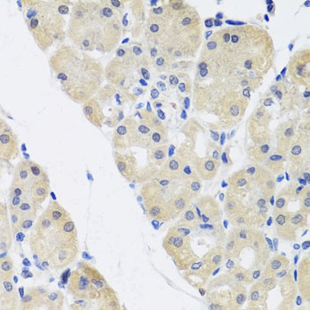 ALAD Antibody