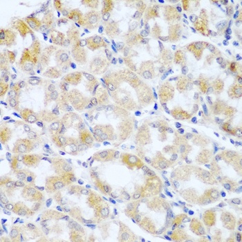 ANKRD52 Antibody