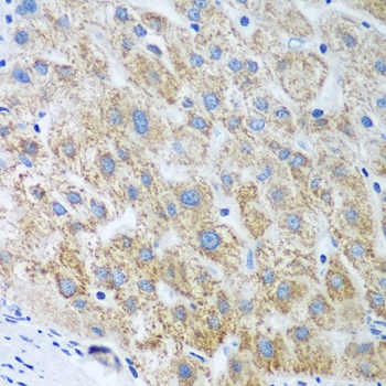 UBE2U Antibody